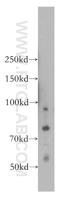 Western Blot (WB) analysis of COLO 320 cells using VPS52 Polyclonal antibody (11662-2-AP)