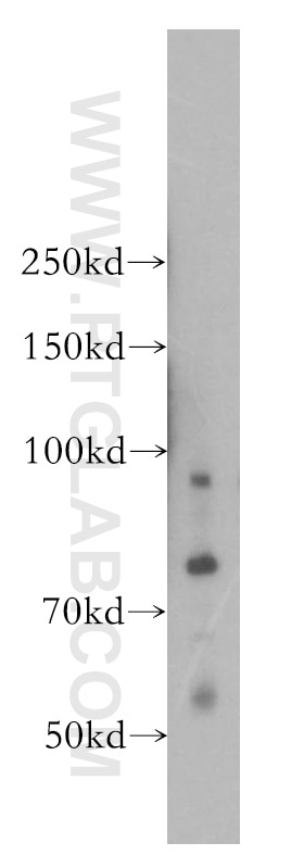 WB analysis of COLO 320 using 11662-2-AP