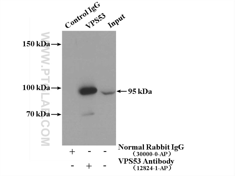 Immunoprecipitation (IP) experiment of mouse liver tissue using VPS53 Polyclonal antibody (12824-1-AP)