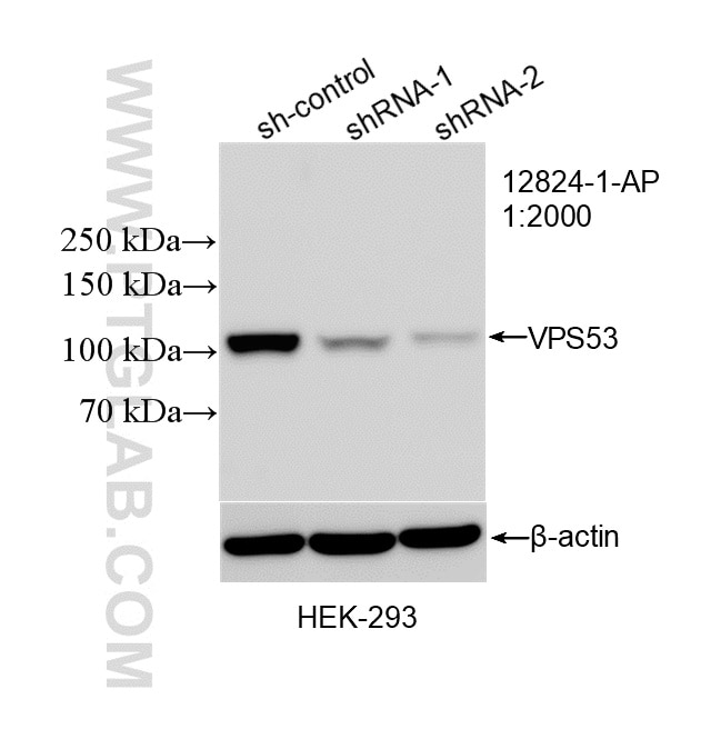 WB result of VPS53 antibody (12824-1-AP; 1:2000; incubated at room temperature for 1.5 hours) with sh-Control and sh-VPS53 transfected HEK-293 cells. Western Blot (WB) analysis of HEK-293 cells using VPS53 Polyclonal antibody (12824-1-AP)