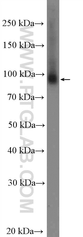 Western Blot (WB) analysis of mouse liver tissue using VPS53 Polyclonal antibody (12824-1-AP)