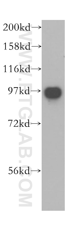 Western Blot (WB) analysis of human liver tissue using VPS53 Polyclonal antibody (12824-1-AP)