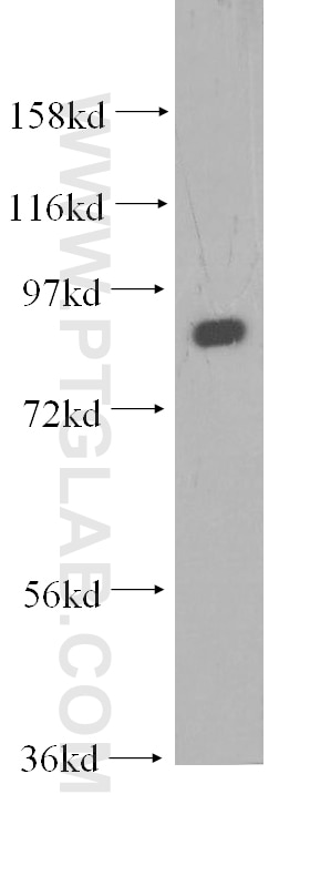 VPS53