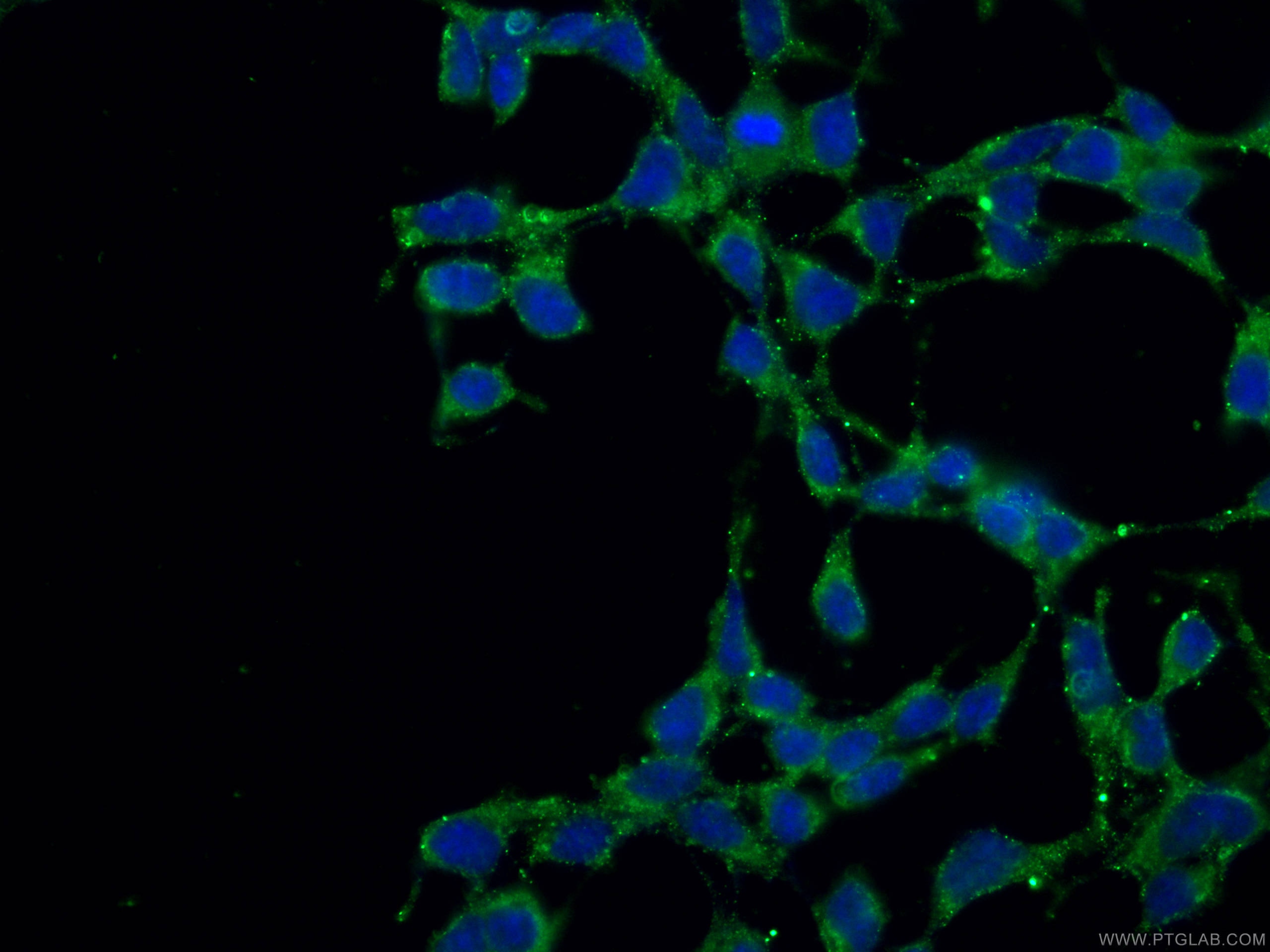 Immunofluorescence (IF) / fluorescent staining of HEK-293 cells using VPS53 Monoclonal antibody (67610-1-Ig)