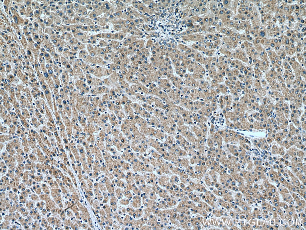 Immunohistochemistry (IHC) staining of human liver tissue using VPS53 Monoclonal antibody (67610-1-Ig)