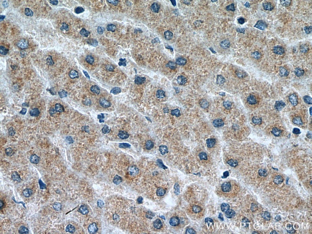 Immunohistochemistry (IHC) staining of human liver tissue using VPS53 Monoclonal antibody (67610-1-Ig)