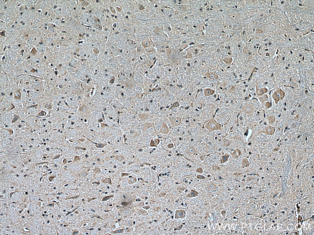 Immunohistochemistry (IHC) staining of rat brain tissue using VPS53 Monoclonal antibody (67610-1-Ig)