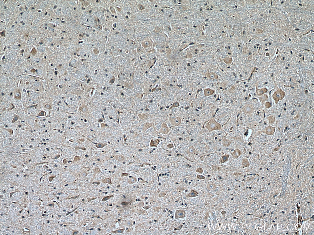 IHC staining of rat brain using 67610-1-Ig