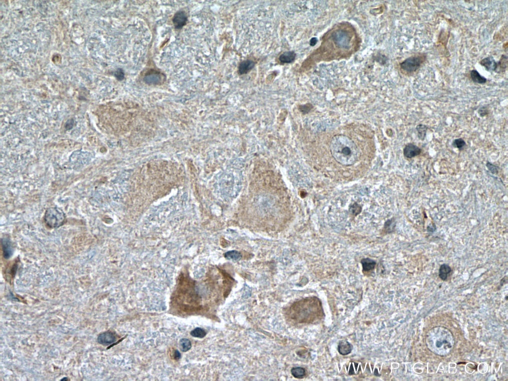 Immunohistochemistry (IHC) staining of rat brain tissue using VPS53 Monoclonal antibody (67610-1-Ig)