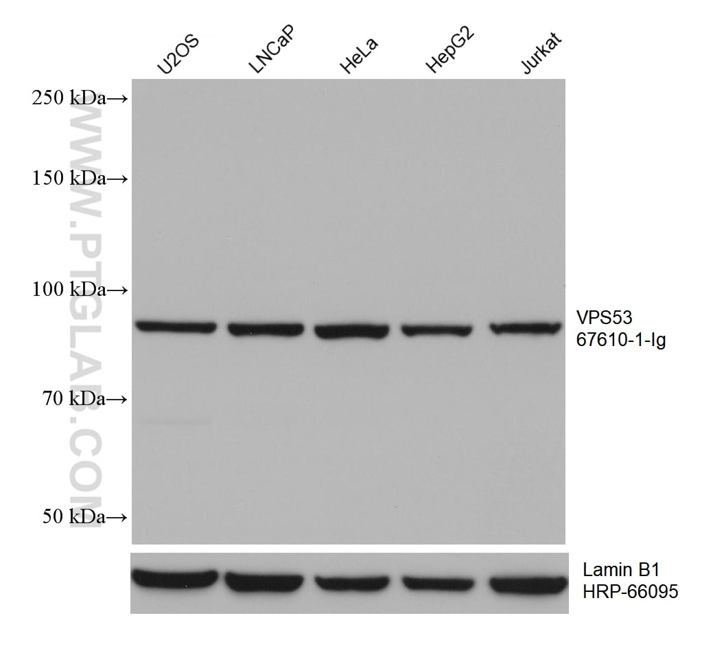 Western Blot (WB) analysis of various lysates using VPS53 Monoclonal antibody (67610-1-Ig)
