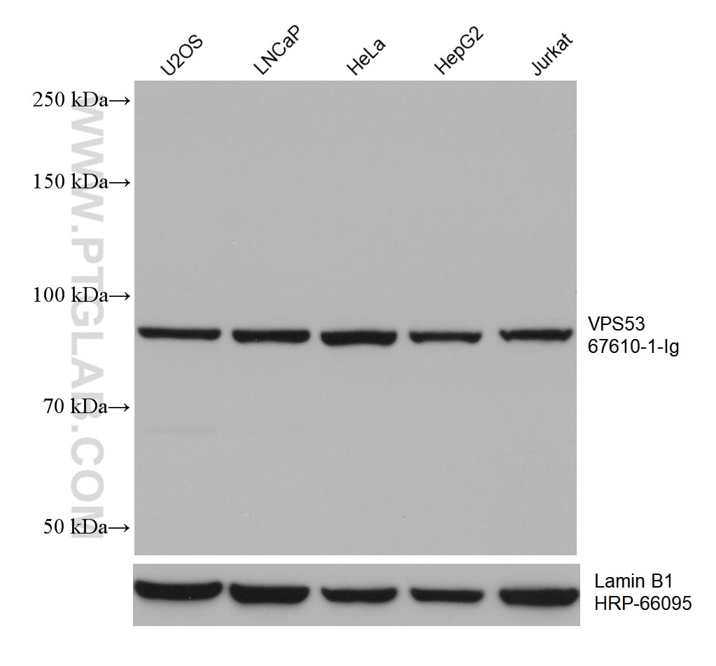 WB analysis using 67610-1-Ig