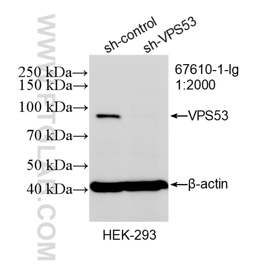 Western Blot (WB) analysis of HEK-293 cells using VPS53 Monoclonal antibody (67610-1-Ig)