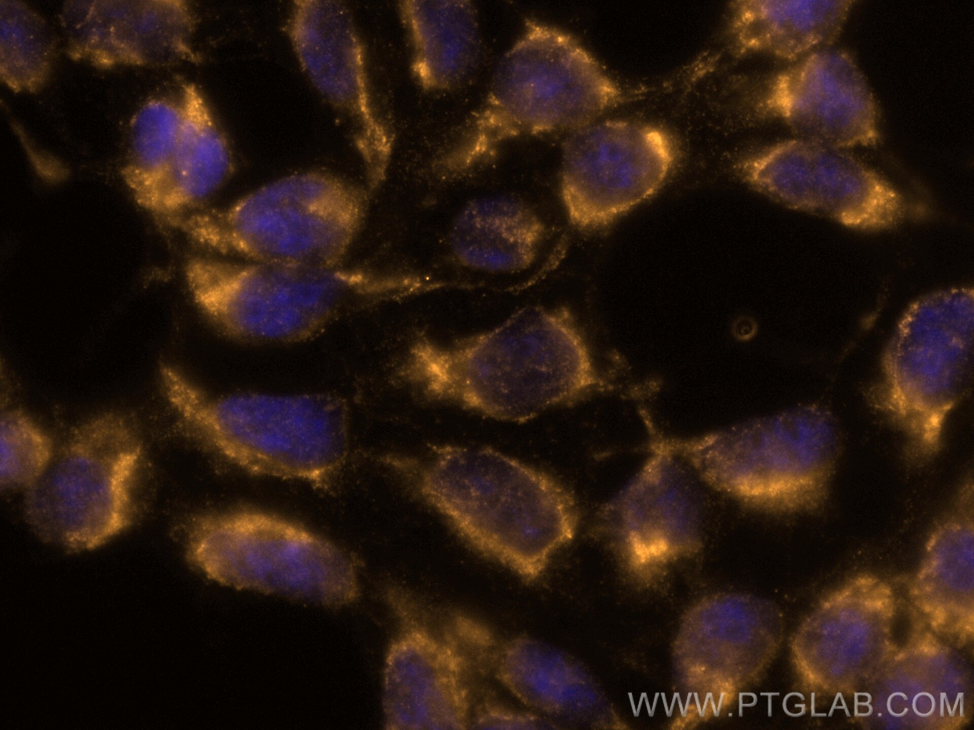 IF Staining of HEK-293 using CL555-67610