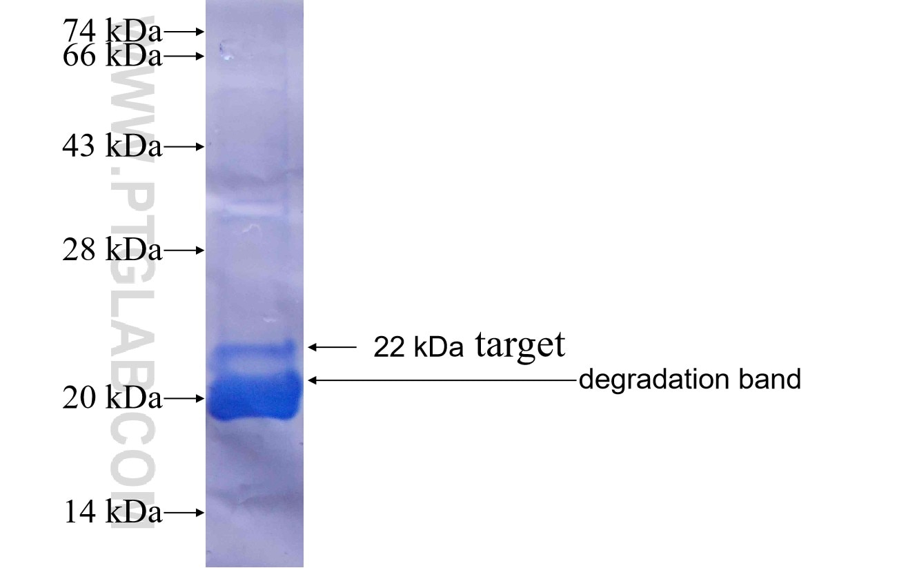 VPS53 fusion protein Ag25142 SDS-PAGE