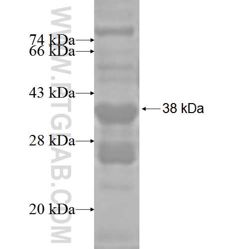 VPS53 fusion protein Ag3518 SDS-PAGE