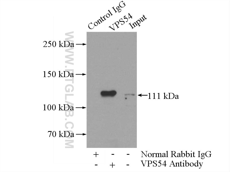 Immunoprecipitation (IP) experiment of mouse brain tissue using VPS54 Polyclonal antibody (13327-1-AP)