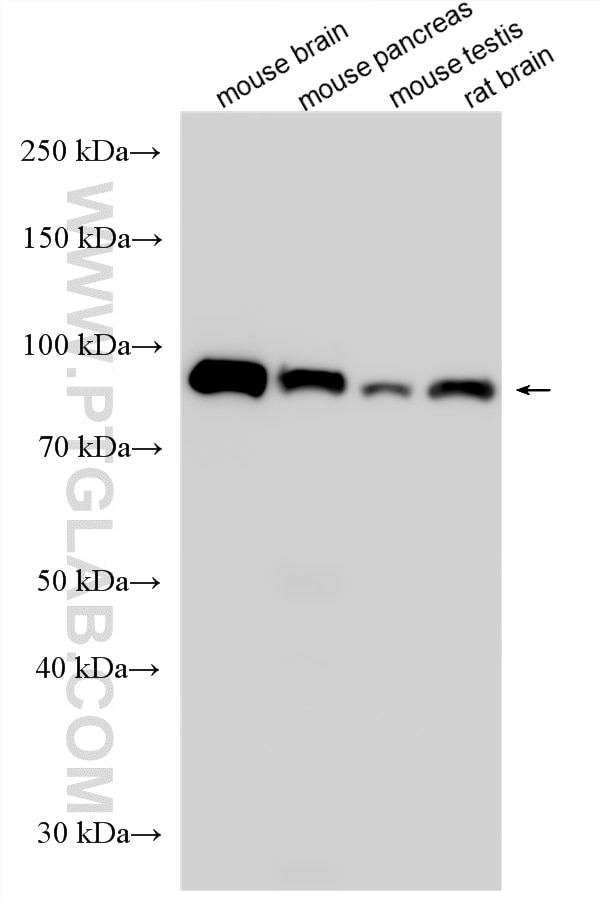 Western Blot (WB) analysis of various lysates using VPS54 Polyclonal antibody (13327-1-AP)