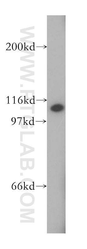 Western Blot (WB) analysis of human brain tissue using VPS54 Polyclonal antibody (13327-1-AP)