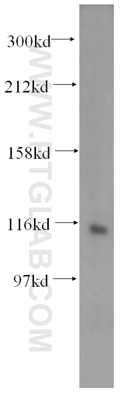 Western Blot (WB) analysis of mouse brain tissue using VPS54 Polyclonal antibody (13327-1-AP)