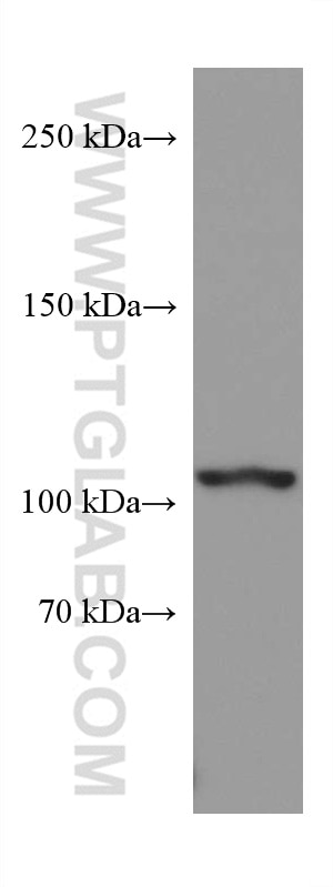 Western Blot (WB) analysis of pig brain tissue using VPS54 Monoclonal antibody (67404-1-Ig)