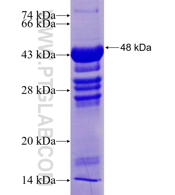 VPS54 fusion protein Ag4123 SDS-PAGE