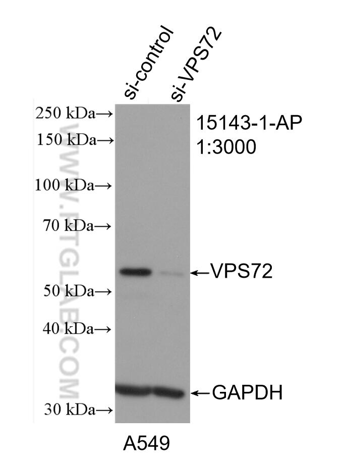Western Blot (WB) analysis of A549 cells using VPS72 Polyclonal antibody (15143-1-AP)