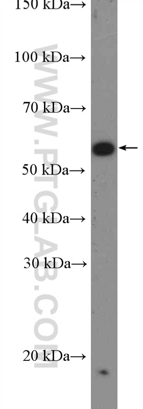 Western Blot (WB) analysis of NIH/3T3 cells using VPS72 Polyclonal antibody (15143-1-AP)