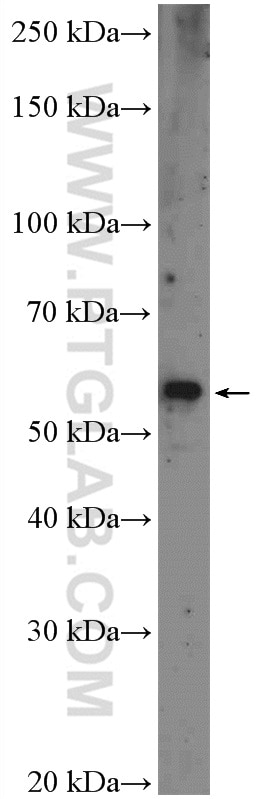 Western Blot (WB) analysis of HeLa cells using VPS72 Polyclonal antibody (15143-1-AP)