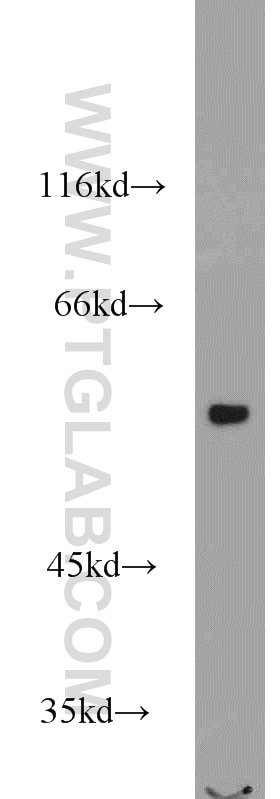 Western Blot (WB) analysis of mouse skeletal muscle tissue using VPS72 Polyclonal antibody (15143-1-AP)