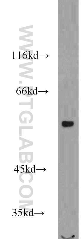 Western Blot (WB) analysis of mouse skeletal muscle tissue using VPS72 Polyclonal antibody (15143-1-AP)