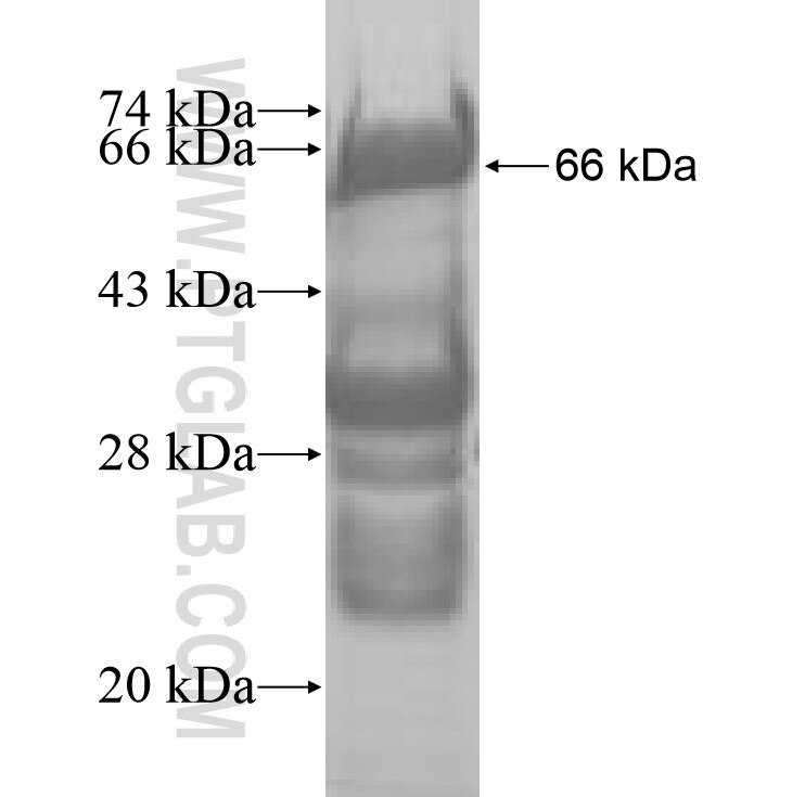 VPS72 fusion protein Ag7420 SDS-PAGE