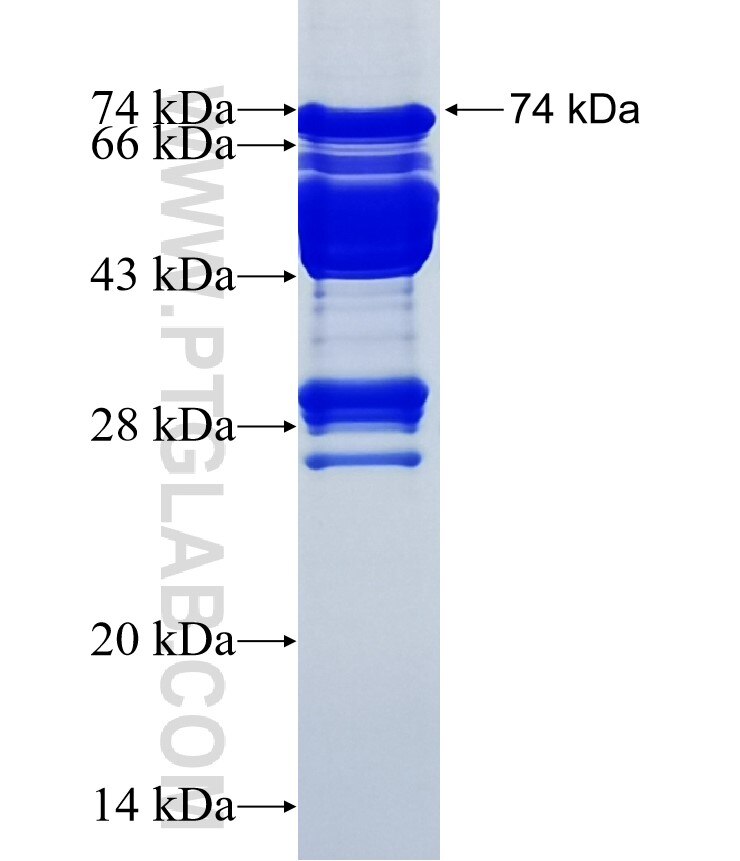 VPS72 fusion protein Ag7424 SDS-PAGE