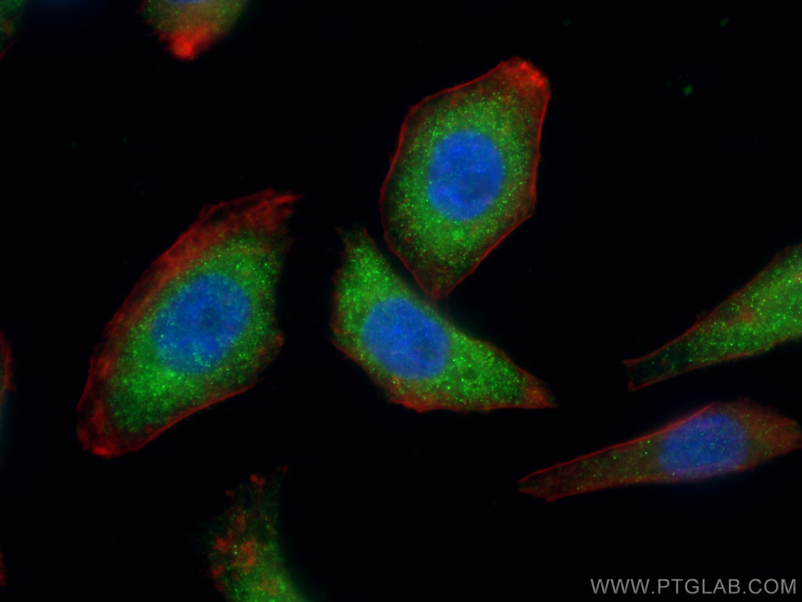 Immunofluorescence (IF) / fluorescent staining of HepG2 cells using VPS8 Polyclonal antibody (15079-1-AP)