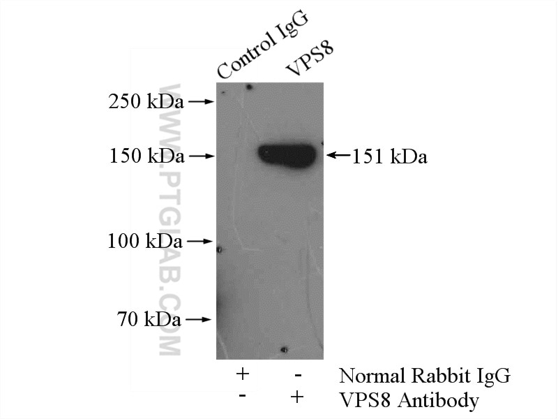 Immunoprecipitation (IP) experiment of mouse brain tissue using VPS8 Polyclonal antibody (15079-1-AP)
