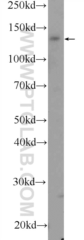 Western Blot (WB) analysis of mouse brain tissue using VPS8 Polyclonal antibody (15079-1-AP)