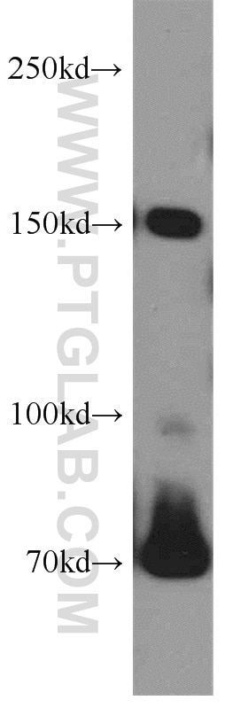 WB analysis of mouse brain using 15079-1-AP