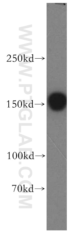 Western Blot (WB) analysis of human brain tissue using VPS8 Polyclonal antibody (15079-1-AP)