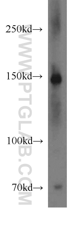 Western Blot (WB) analysis of mouse liver tissue using VPS8 Polyclonal antibody (15079-1-AP)