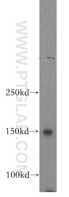 Western Blot (WB) analysis of human testis tissue using VPS8 Polyclonal antibody (15079-1-AP)
