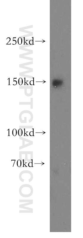 Western Blot (WB) analysis of PC-3 cells using VPS8 Polyclonal antibody (15079-1-AP)