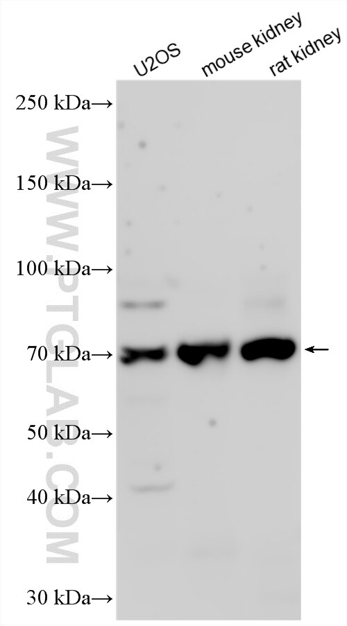 WB analysis using 34064-1-AP Western Blot (WB) analysis of various lysates using VPS9D1 Polyclonal antibody (34064-1-AP)
