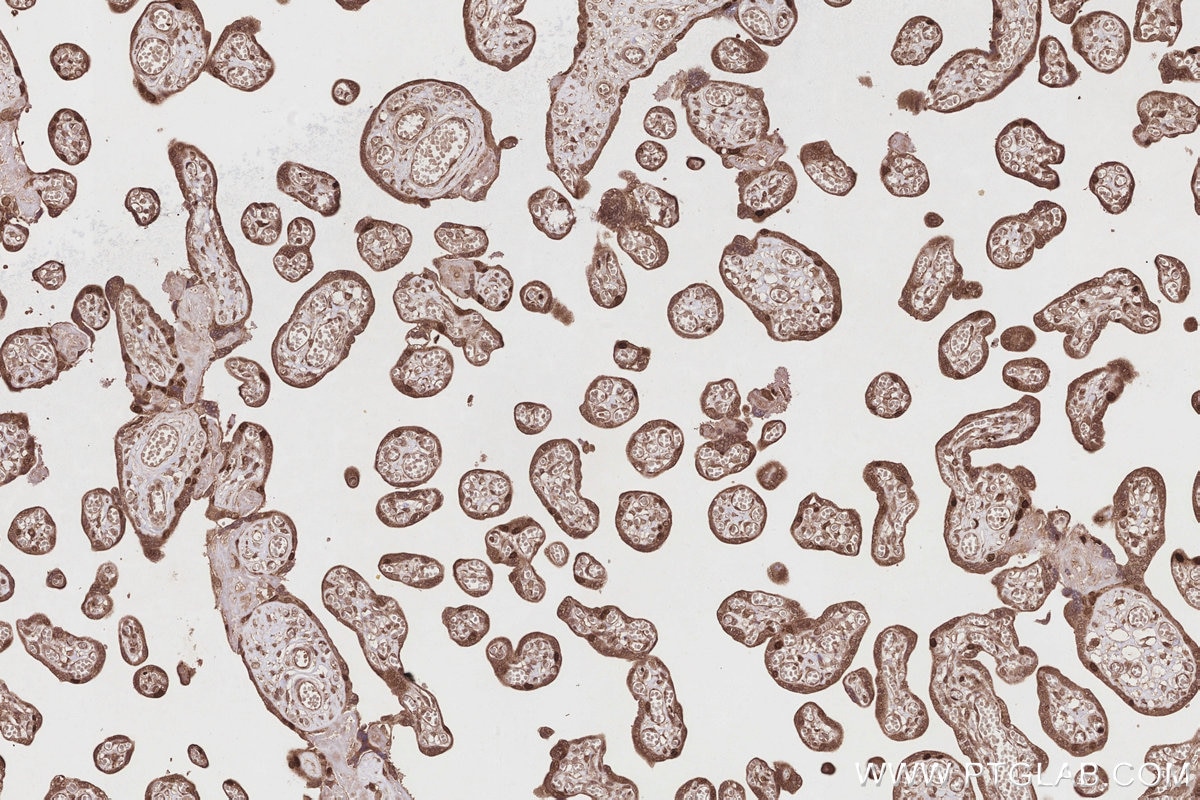 IHC staining of human placenta using 28018-1-AP Immunohistochemistry (IHC) staining of human placenta tissue using VRK1 Polyclonal antibody (28018-1-AP)
