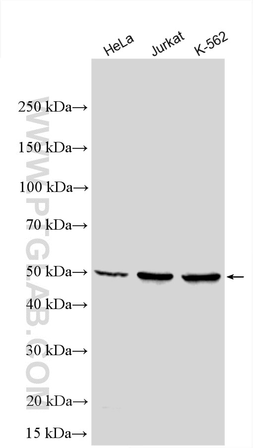 Western Blot (WB) analysis of various lysates using VRK1 Polyclonal antibody (28018-1-AP)