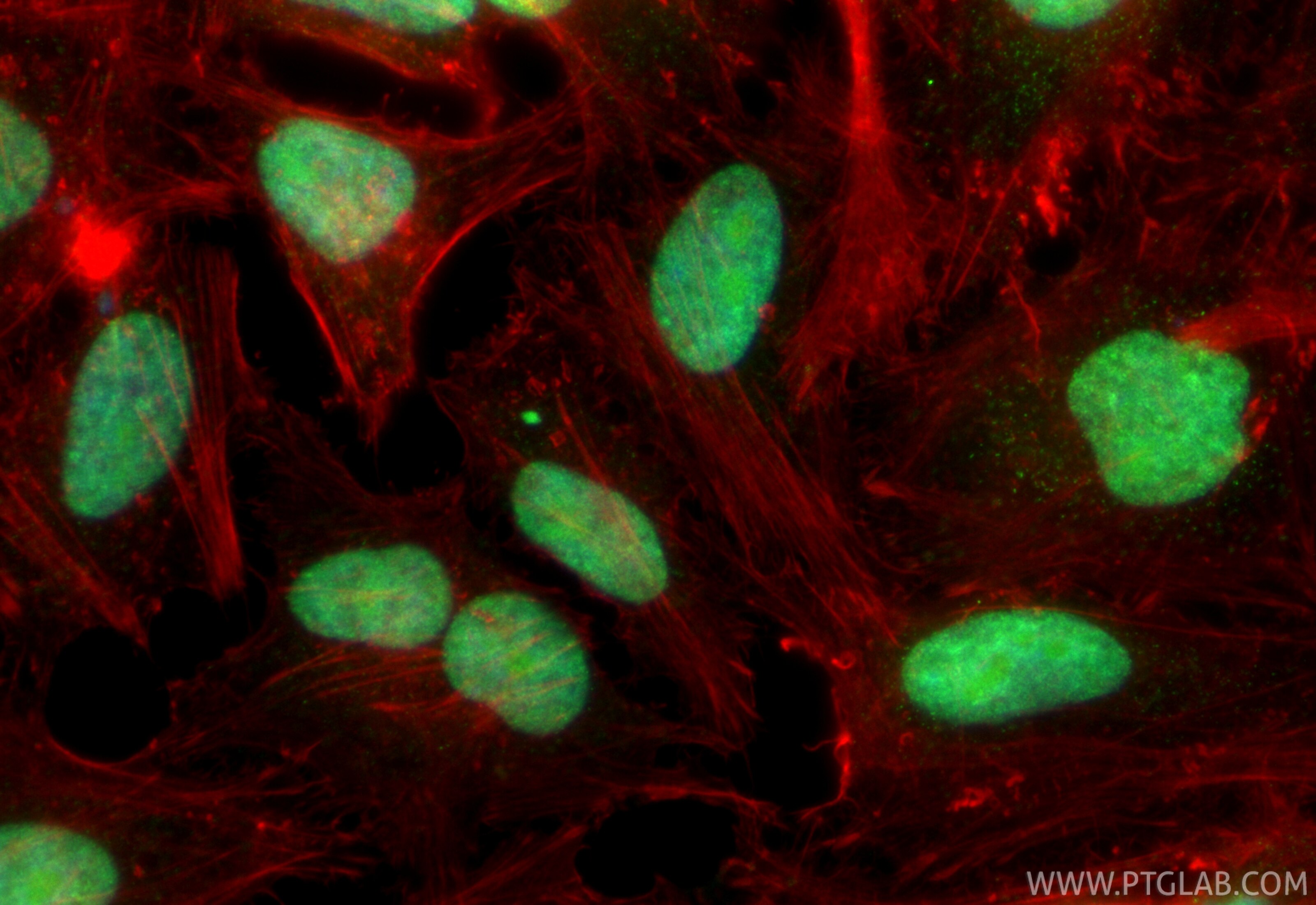 Immunofluorescence (IF) / fluorescent staining of HeLa cells using CoraLite® Plus 488-conjugated VRK1 Recombinant mon (CL488-85598-2)