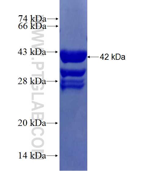 VRK1 fusion protein Ag27754 SDS-PAGE