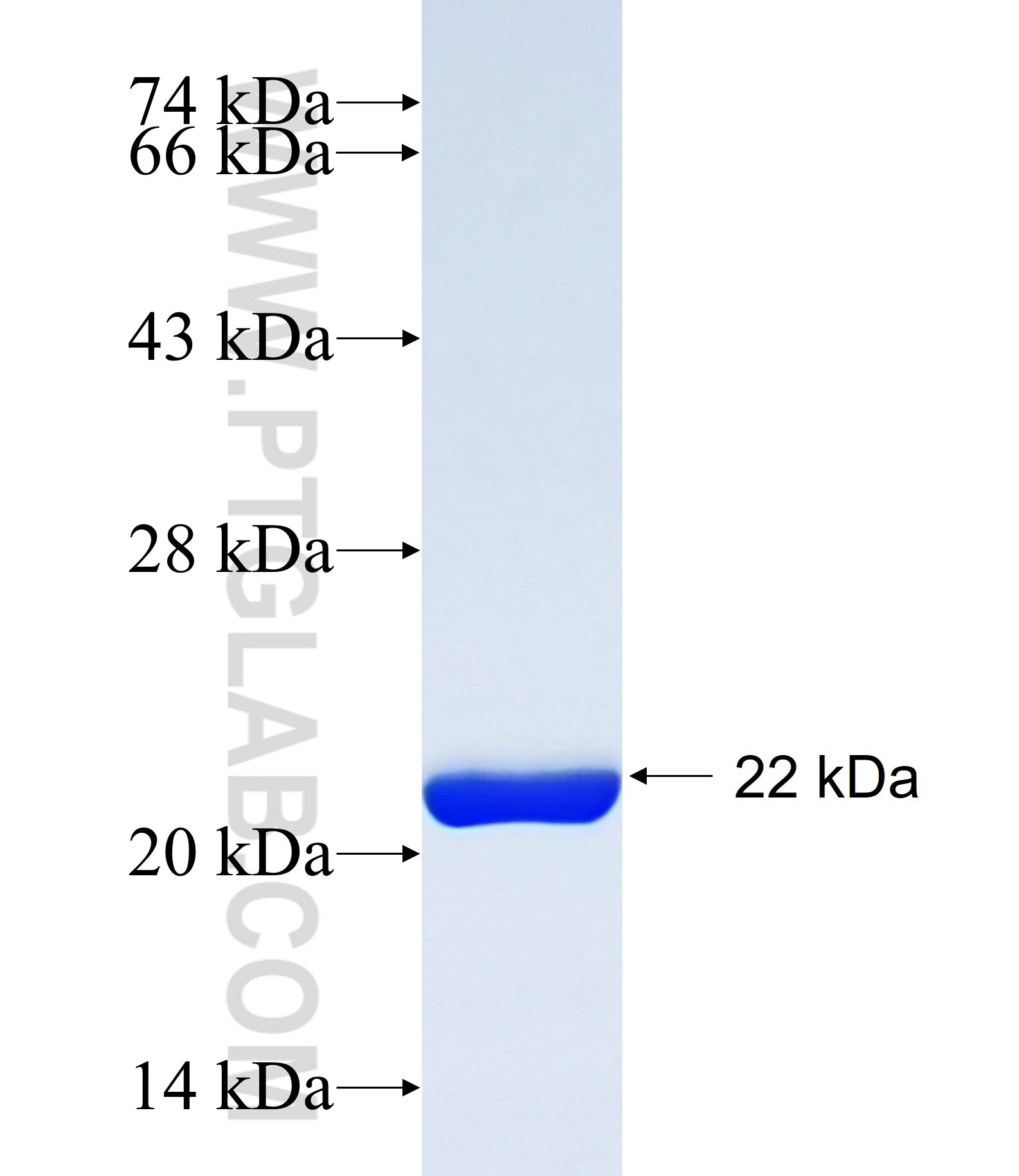 VRK1 fusion protein Ag27766 SDS-PAGE