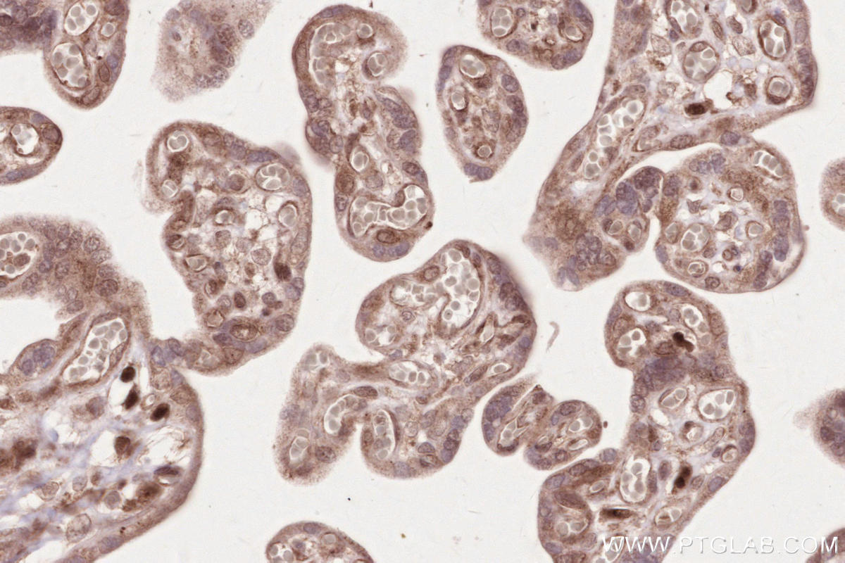 Immunohistochemistry (IHC) staining of human placenta tissue using VRK2 Polyclonal antibody (12946-1-AP)