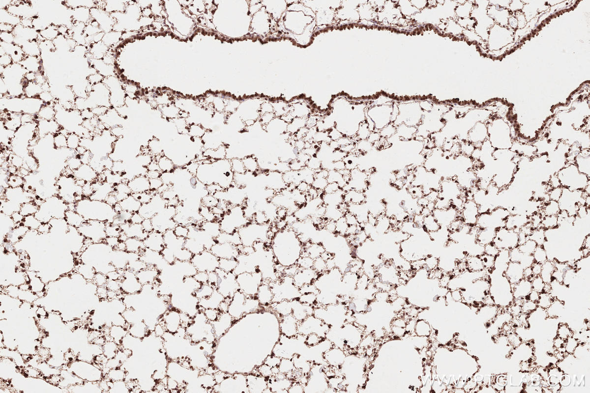 Immunohistochemistry (IHC) staining of mouse lung tissue using VRK2 Polyclonal antibody (12946-1-AP)