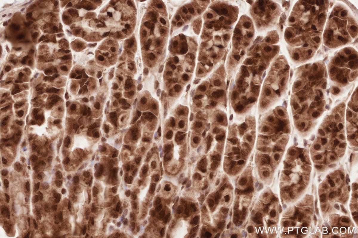 Immunohistochemistry (IHC) staining of mouse stomach tissue using VRK2 Polyclonal antibody (12946-1-AP)