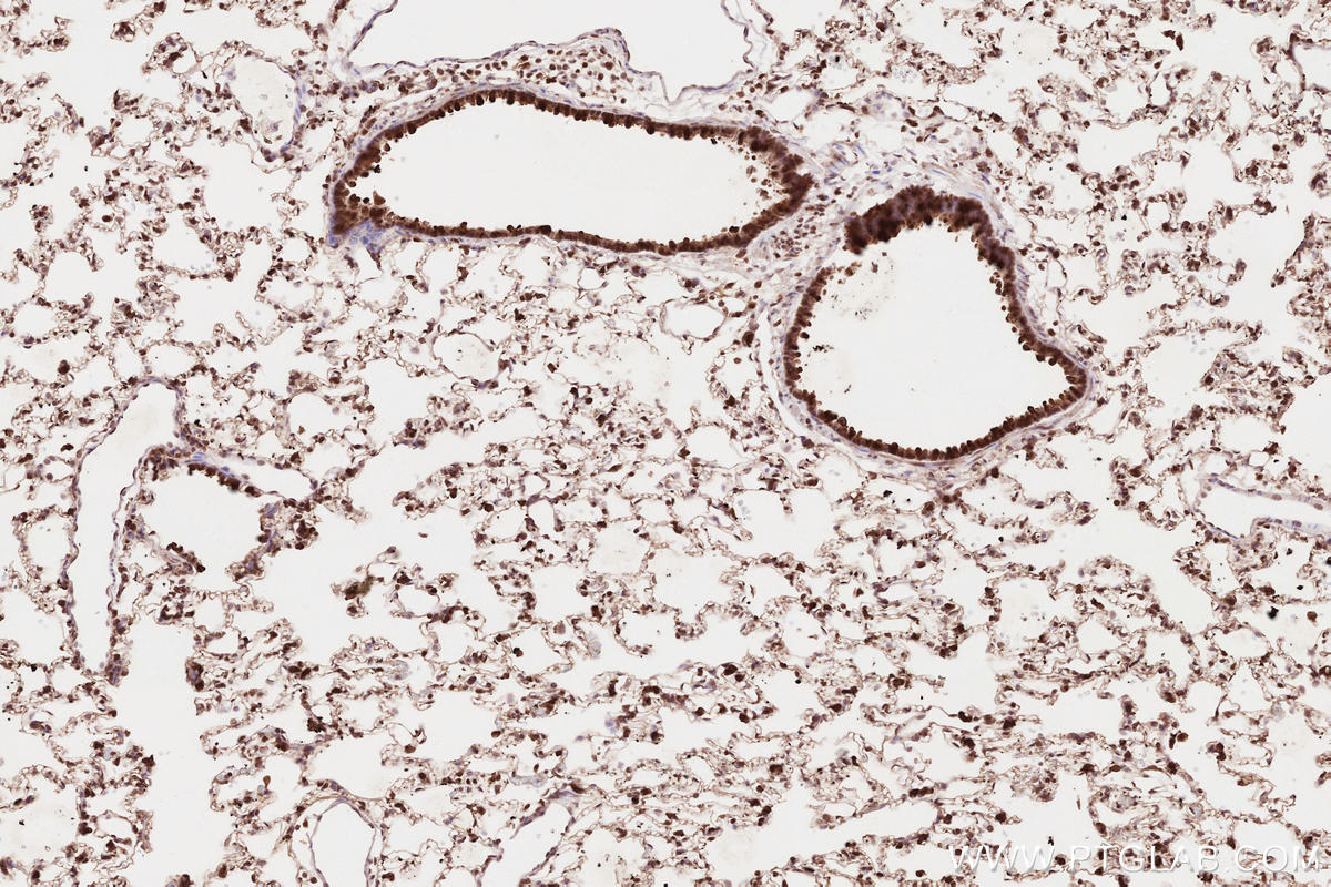 Immunohistochemistry (IHC) staining of rat lung tissue using VRK2 Polyclonal antibody (12946-1-AP)